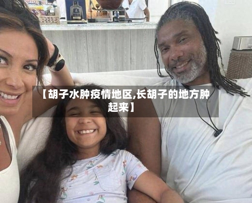 【胡子水肿疫情地区,长胡子的地方肿起来】-第3张图片