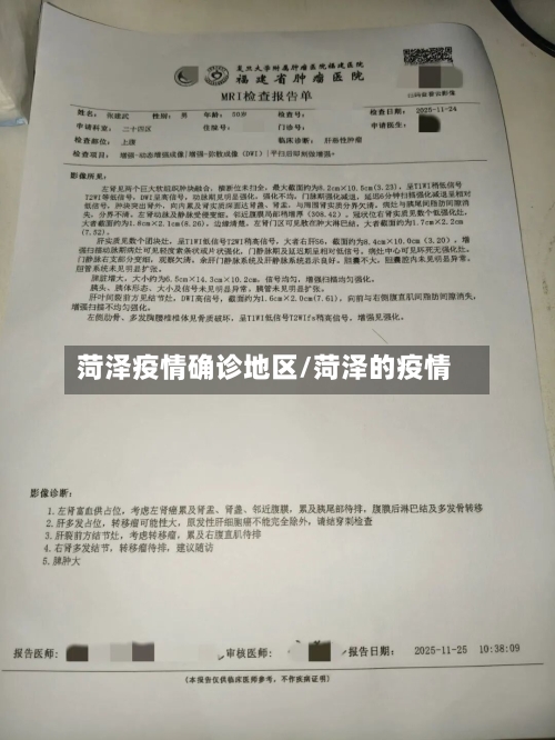 菏泽疫情确诊地区/菏泽的疫情-第3张图片