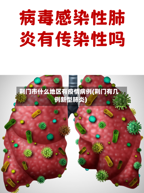 荆门市什么地区有疫情病例(荆门有几例新型肺炎)-第3张图片