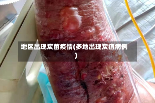 地区出现炭菌疫情(多地出现炭疽病例)